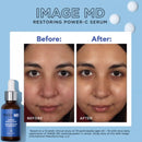 IMAGE Skincare MD restoring power c serum