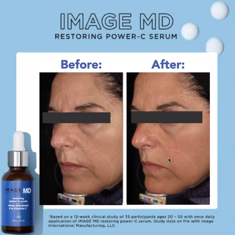 IMAGE Skincare MD restoring power c serum
