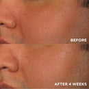 Brightening Boost Skincare System