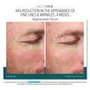 FACTORFIVE Regenerative Serum
