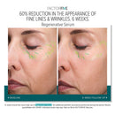 FACTORFIVE Regenerative Serum