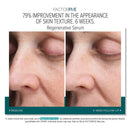 FACTORFIVE Regenerative Serum
