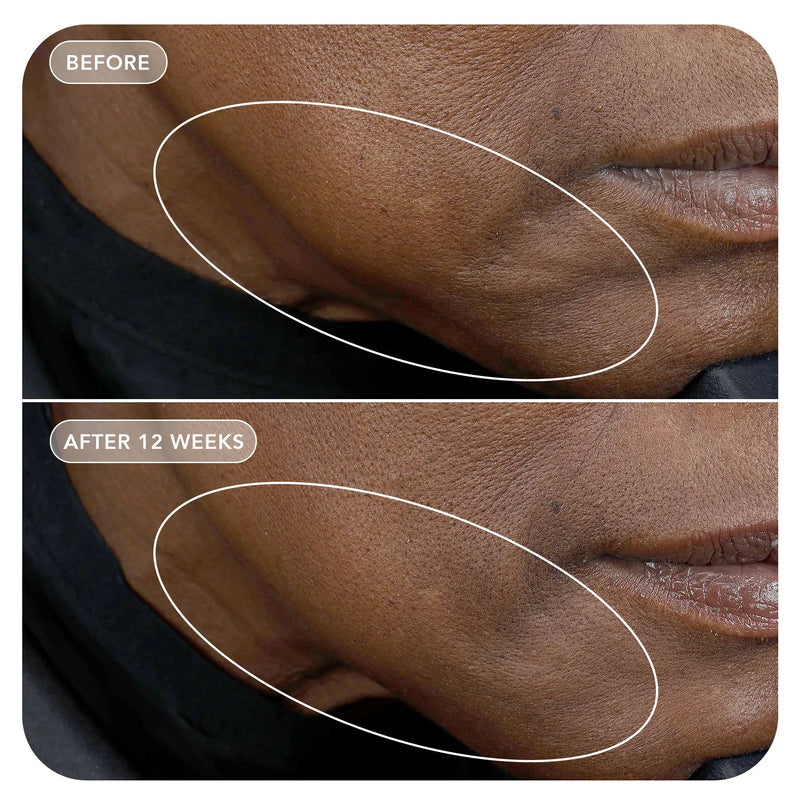 VOL.U.LIFT GLP-1 4D Skin Rebound Complex VOL.U.LIFT GLP-1 4D Skin Rebound Complex
