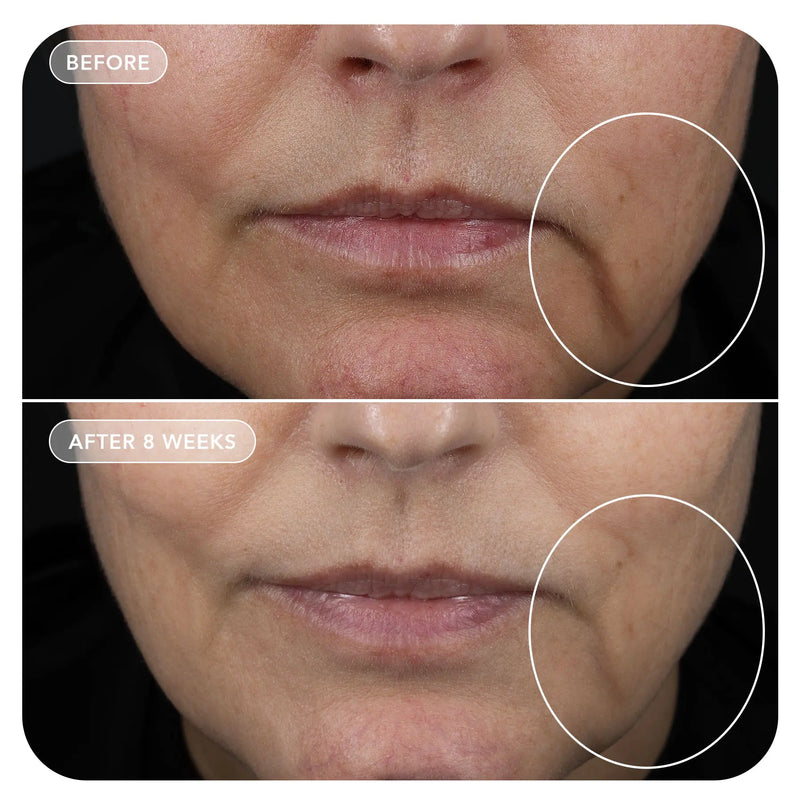 glp 1 dry skin VOL.U.LIFT™ GLP-1 4D Skin Rebound Complex