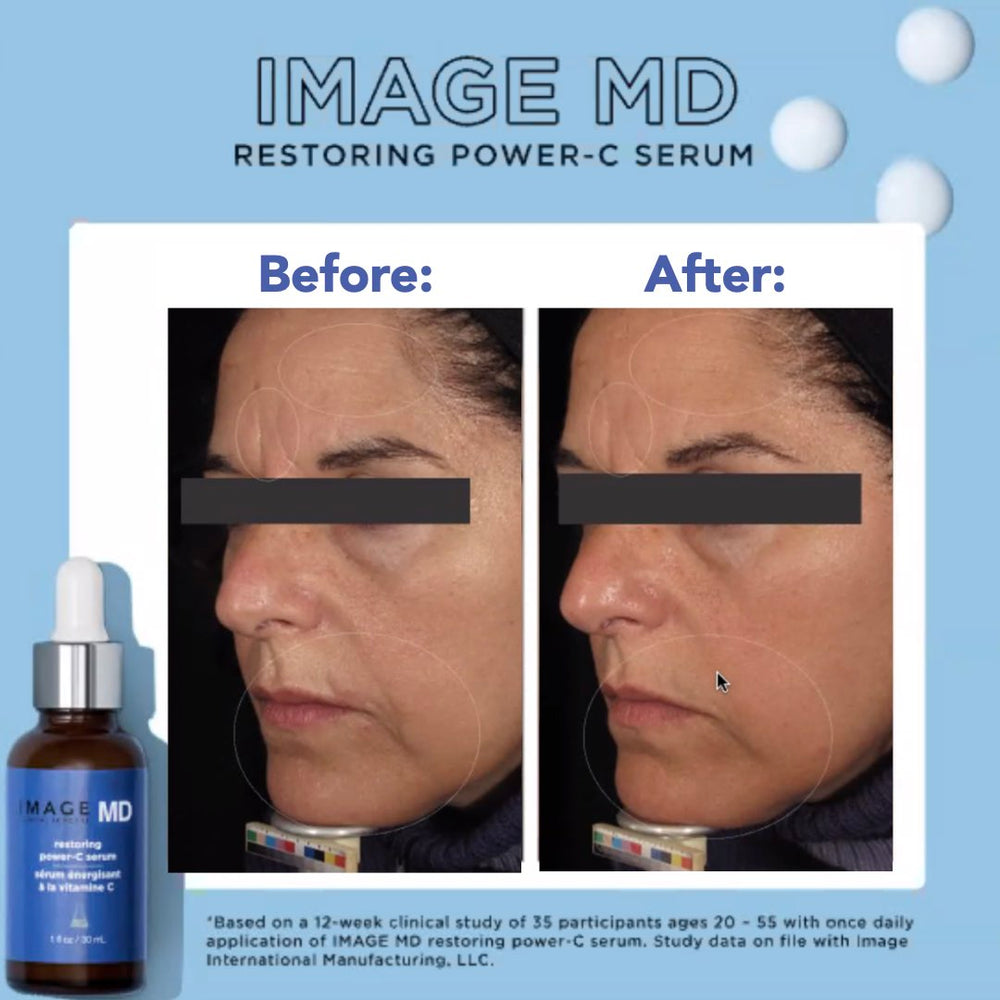 IMAGE SKINCARE MD Restoring Power-C Serum (100% outlet New & Authentic)