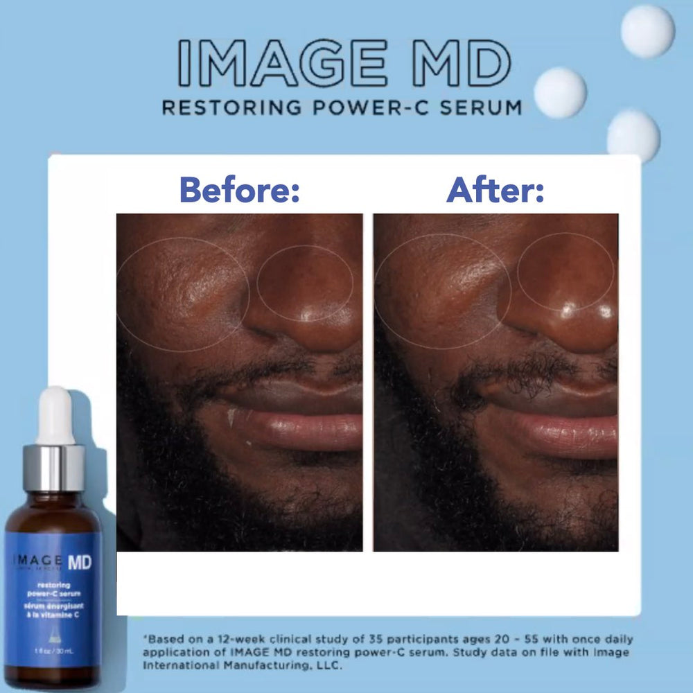 IMAGE SKINCARE MD Restoring Power-C Serum (100% outlet New & Authentic)